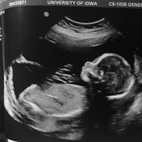 14081119_1825971590964771_105449575_n